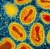 Por que os casos de varíola dos macacos estão aumentando na Europa